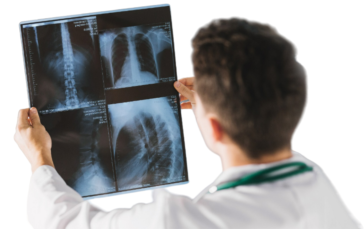 Рентген легких | ОРИС, комплексная диагностика, лечение и профилактика в  Москве и Московской области
